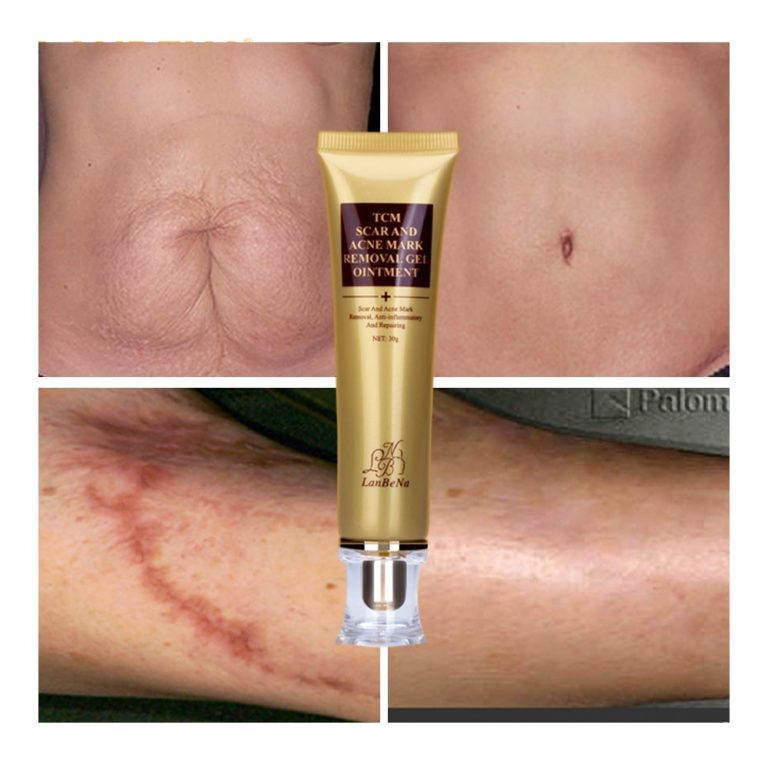 LANBENA Acne Scar Removal Cream Skin Repair GearBeauty lanbena-acne-scar-removal-cream-skin-repair-gearbeauty