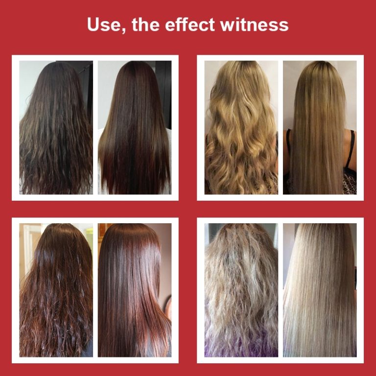LANBENA Fast Powerful Hair Growth Essence Products Essential Oil Liquid ...